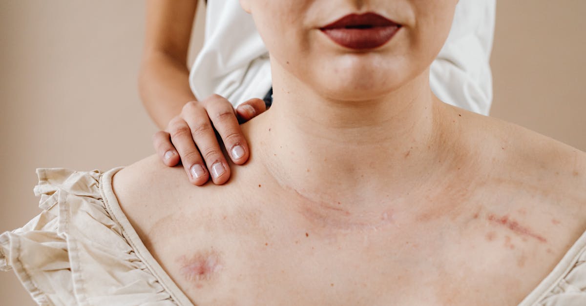 découvrez des stratégies efficaces pour se libérer de la dépendance émotionnelle et retrouver votre équilibre personnel et bien-être.