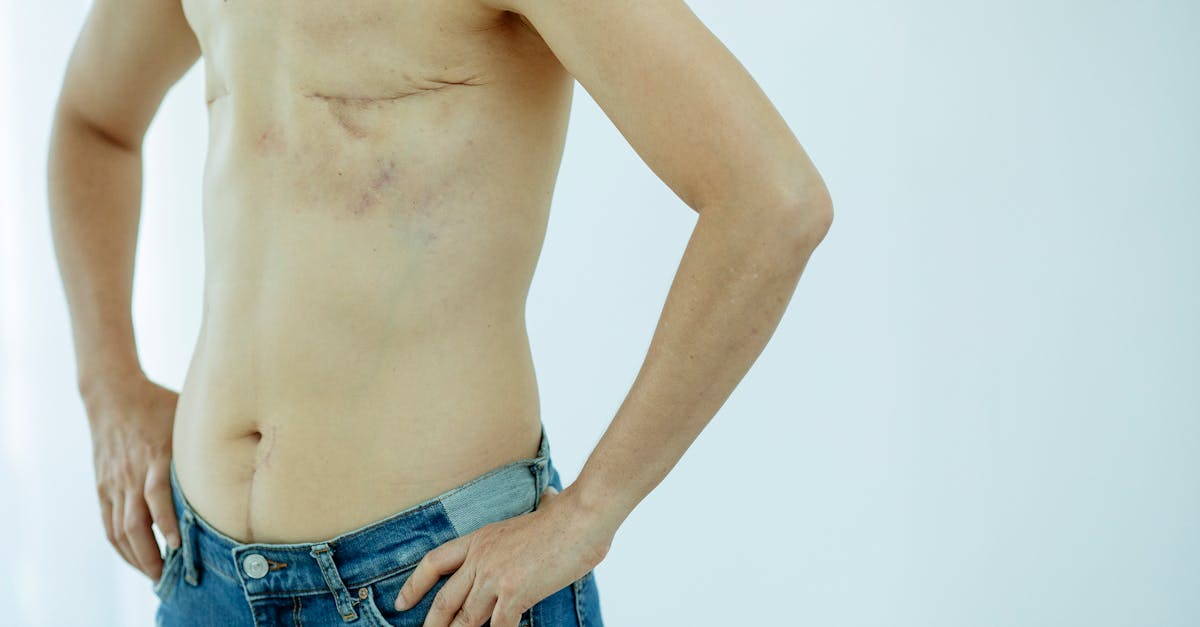 découvrez des méthodes efficaces pour surmonter une rupture et reconstruire votre vie après une séparation. conseils, soutien et astuces pour guérir et avancer.