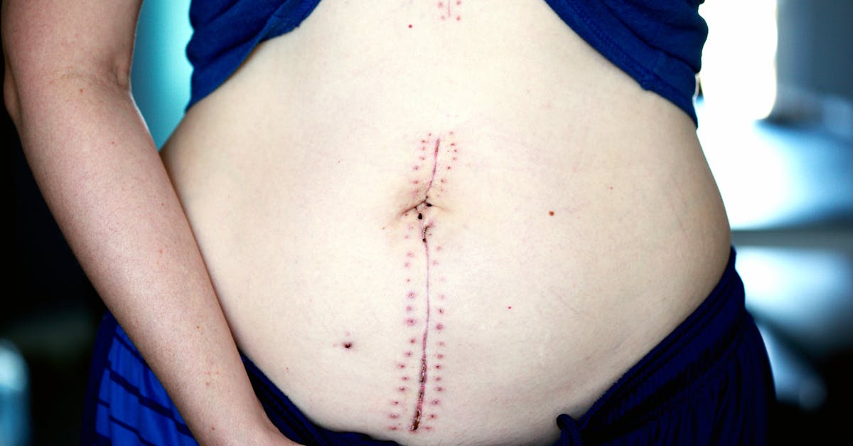 découvrez des conseils et astuces pour récupérer après une rupture amoureuse avec ex recovery, votre guide pour tourner la page et retrouver le bonheur.